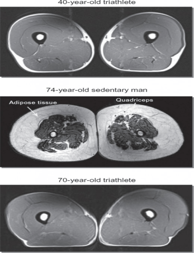 muscle mass loss
